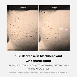 Medicube Zero Pore One-day Serum UAE
