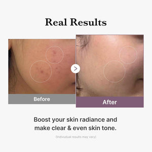 Medicube – Age-R Glutathione Glow Toner