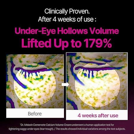 DR. MELAXIN CEMENRETE CALCIUM INTENSE CREAM 50ML