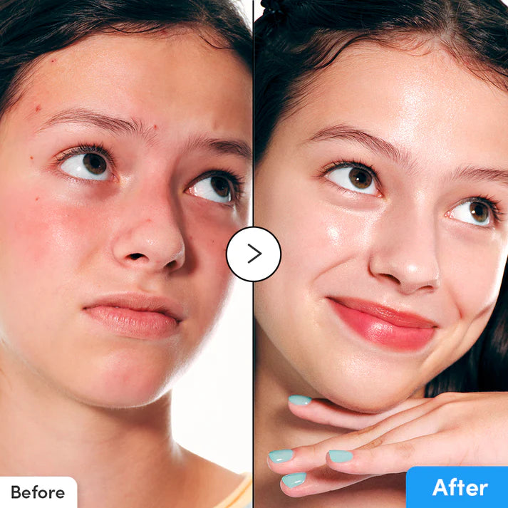 EQQUALBERY HYALTOIN FLOODING SRM 30ML